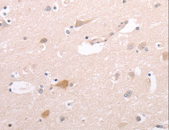 CIDEB Antibody