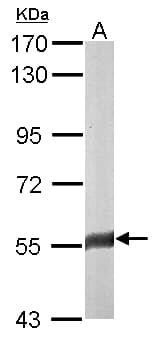 FAM126A / HCC Antibody (aa178-446)