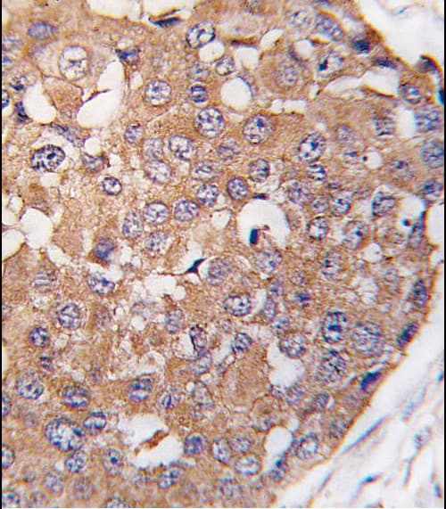 SNK / PLK2 Antibody (aa375-406)