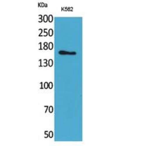 LAMC2 / Laminin Gamma 2 Antibody (C-terminal)