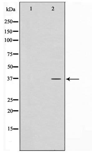 CTU1 Antibody