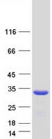 Human ARHGDIA / RHOGDI Protein (Recombinant Myc-DDK (Flag))