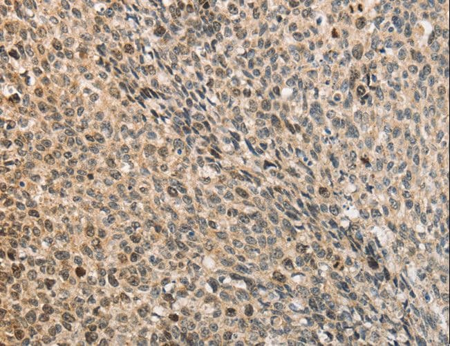 CDCA8 / Borealin Antibody
