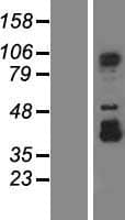 SPICE1 / CCDC52 Protein (Over-Expression Lysate Myc-DDK (Flag))