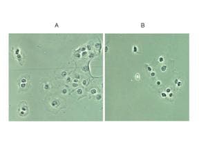 Polyclonal Rabbit anti-Human RELA / NFKB p65 Antibody (IHC, IF, WB)