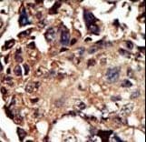 Polyclonal Rabbit anti-Human Syndapin I / PACSIN1 Antibody (aa8-38, IHC, WB)