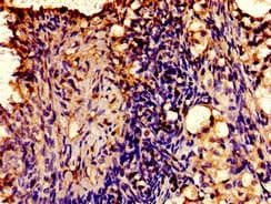 AVPR2 / V2R Antibody