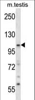 Polyclonal Rabbit anti-Human SNX14 Antibody (aa580-608, WB)