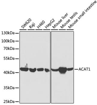 Polyclonal Rabbit anti-Human ACAT1 Antibody (IHC, WB)