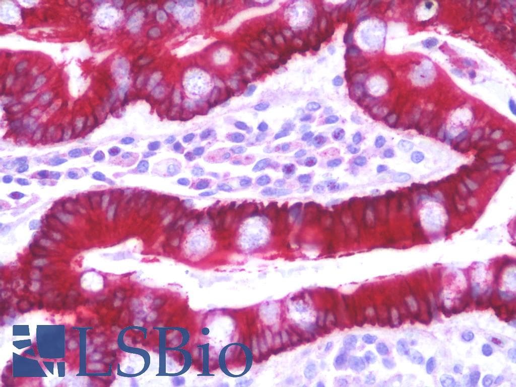 IHC-plus™ SLC35D2 Antibody