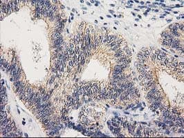 Monoclonal Mouse anti-Human EIF4E2 / IF4e Antibody (clone OTI1F2, IHC, WB)