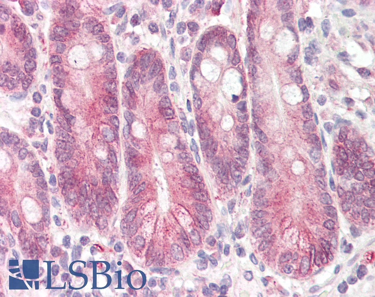 IHC-plus™ STAP2 Antibody (aa437-449)
