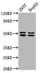 TRNT1 / CCA1 Antibody