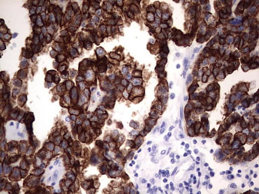 KRT19 / CK19 / Cytokeratin 19 Antibody (aa240-390, clone OTI8A1)