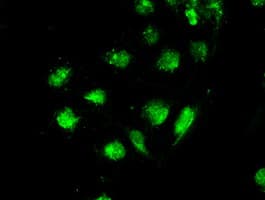 STK39 / SPAK Antibody (clone OTI3C12)