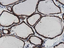 Monoclonal Mouse anti-Human MYD88 Antibody (clone OTI2B2, IHC, IF, WB)