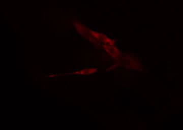 Polyclonal Rabbit anti-Human MARK4 Antibody (IF, WB)
