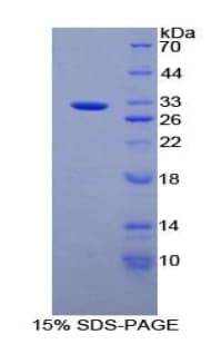 Rat ANPEP / CD13 Protein (Recombinant His-T7)