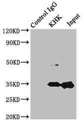 Polyclonal Rabbit anti-Human KHK / Ketohexokinase Antibody (IHC, WB)