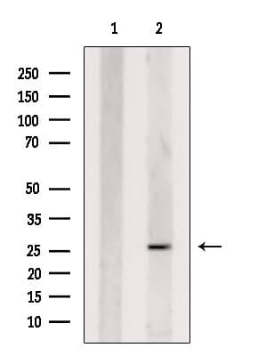 Polyclonal Rabbit anti-Human CHMP1B Antibody (IF, WB)