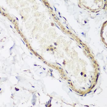 CAV3 / Caveolin 3 Antibody