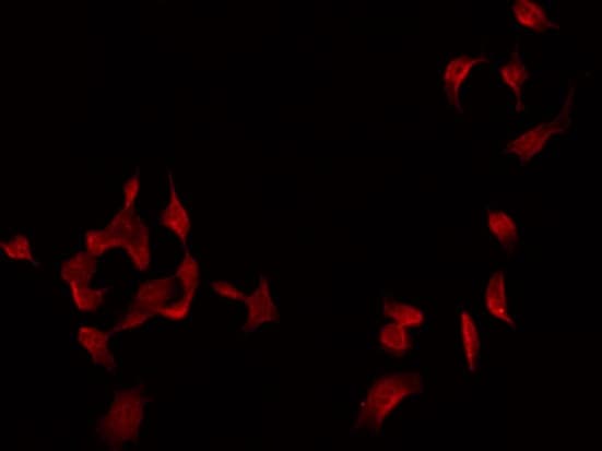 CFI / Complement Factor I Antibody