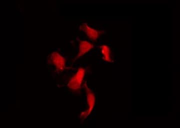 Polyclonal Rabbit anti-Human NF2 / Merlin Antibody (phospho-Ser518, IF, WB)
