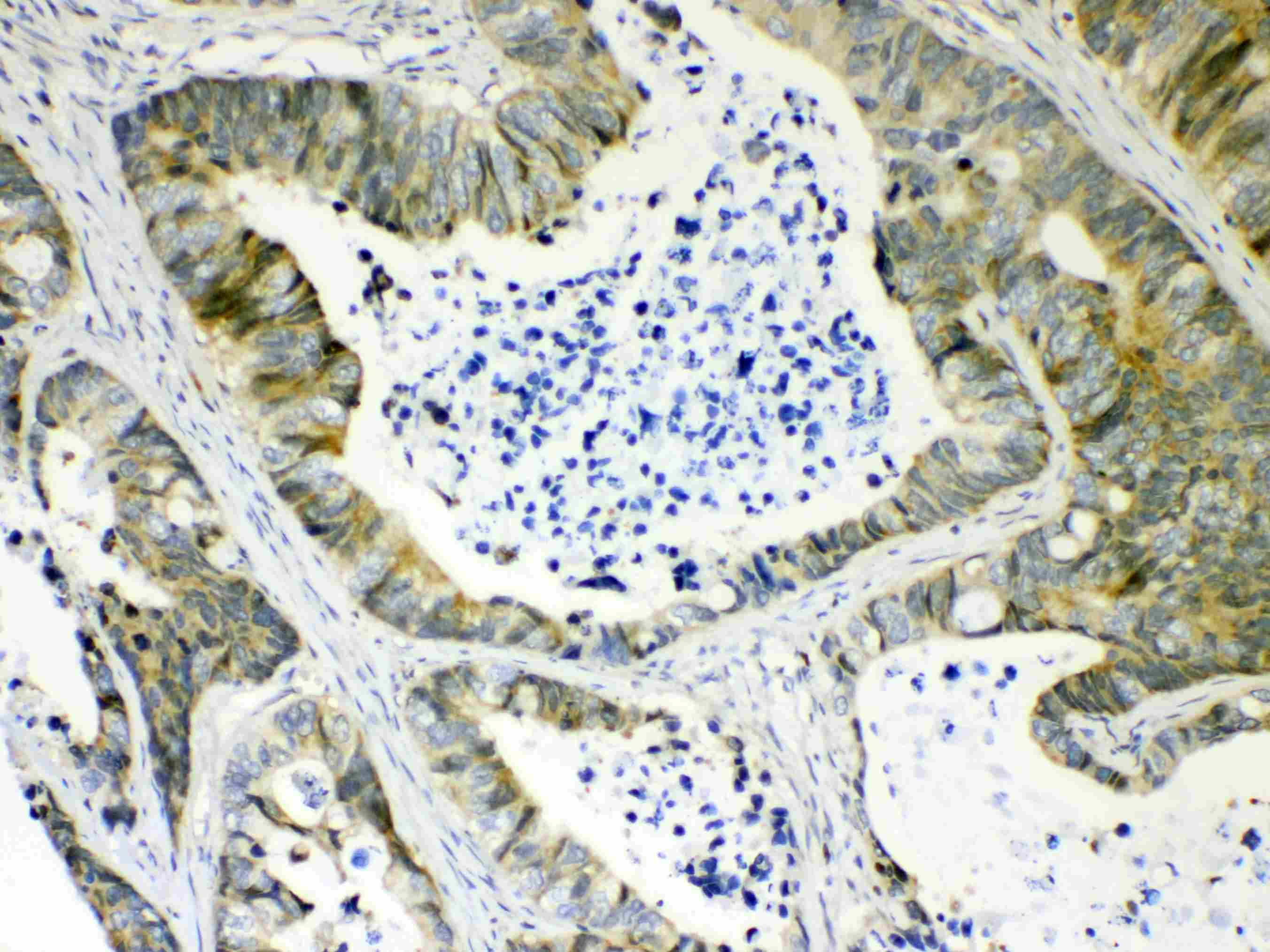 AKR1B10 Antibody