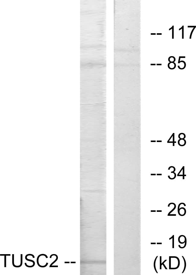 IHC-plus™ TUSC2 / FUS1 Antibody (aa41-90)