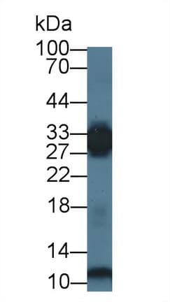 PGAM2 Antibody (aa1-236, FITC)