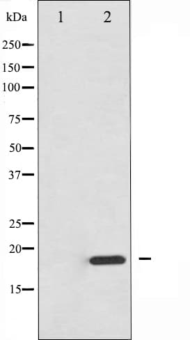 Polyclonal Rabbit anti-Human EIF4EBP1 / 4EBP1 Antibody (IHC, IF, WB)