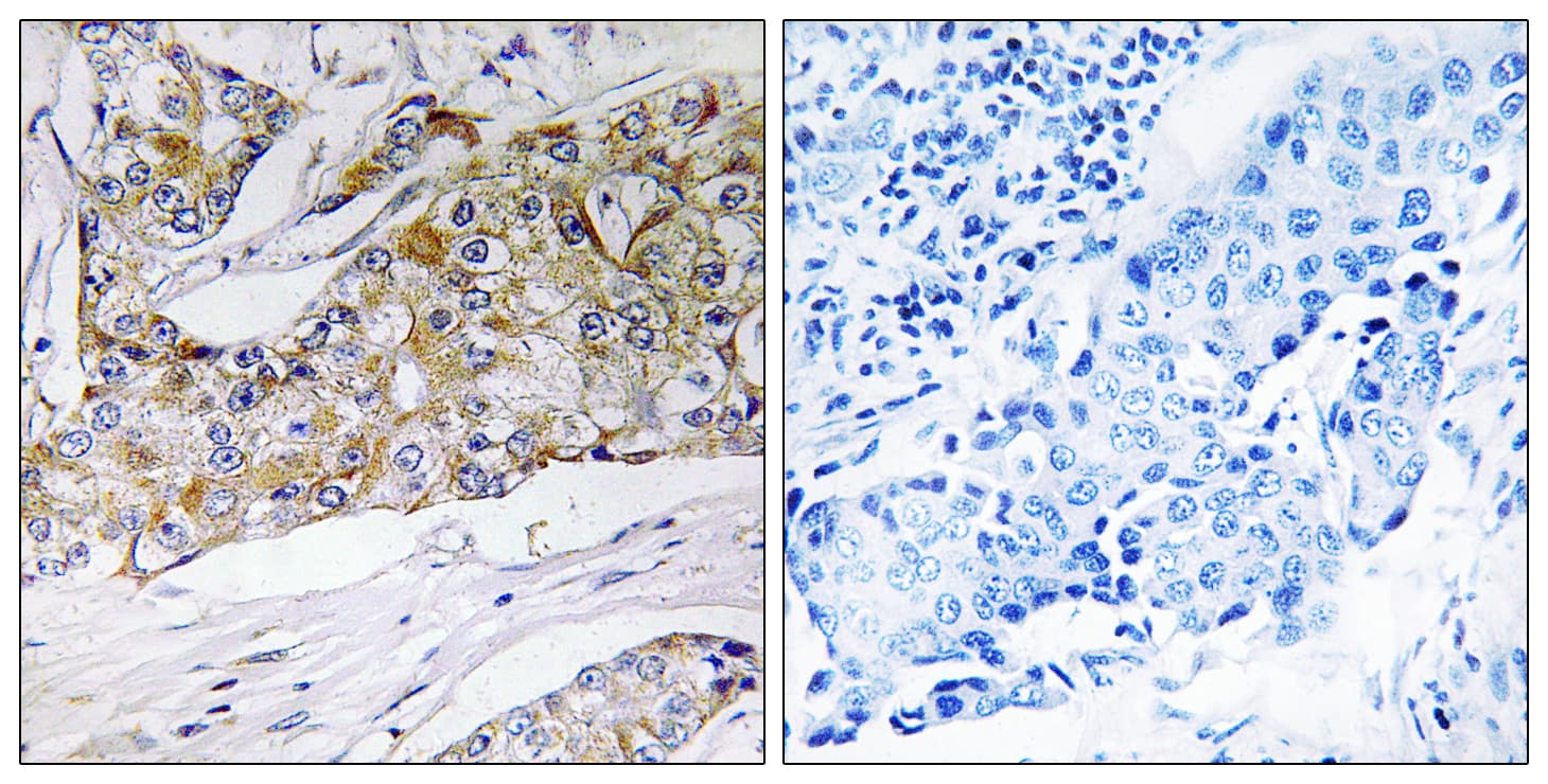 Polyclonal Rabbit anti-Human DHRS11 / MGC4172 Antibody (aa111-160, IHC)