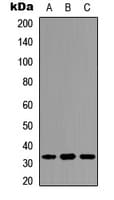 PPP1R1B / DARPP-32 Antibody (phospho-Thr34)