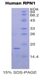 Human RPN1 / Ribophorin I Protein (Recombinant His)