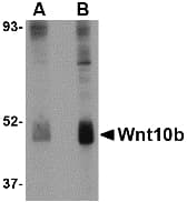 Polyclonal Rabbit anti-Human WNT10B Antibody (IHC, WB)
