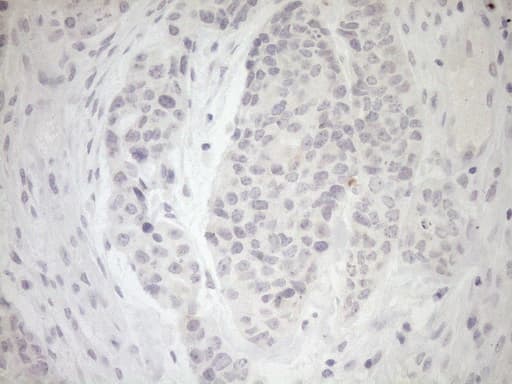 Monoclonal Mouse anti-Human Myozenin / MYOZ1 Antibody (clone OTI4C2, aa106-299, IHC, WB)