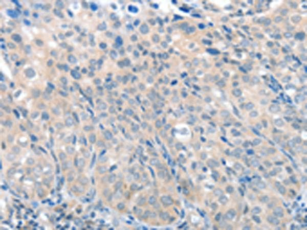 Polyclonal Rabbit anti-Human SLC17A6 / VGLUT2 Antibody (IHC)