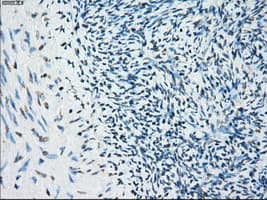 BUB1B / BubR1 Antibody (clone OTI3D9)