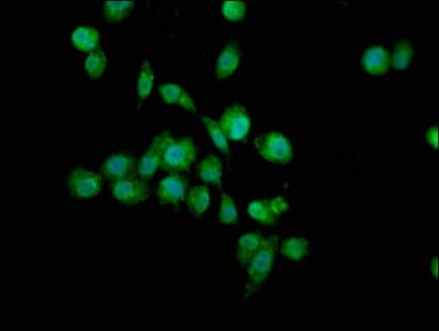Polyclonal Rabbit anti-Human TGM4 / Transglutaminase 4 Antibody (aa1-684, IHC, IF)
