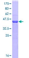 Human SIRT1 / Sirtuin 1 Protein (Recombinant GST, N-terminus)