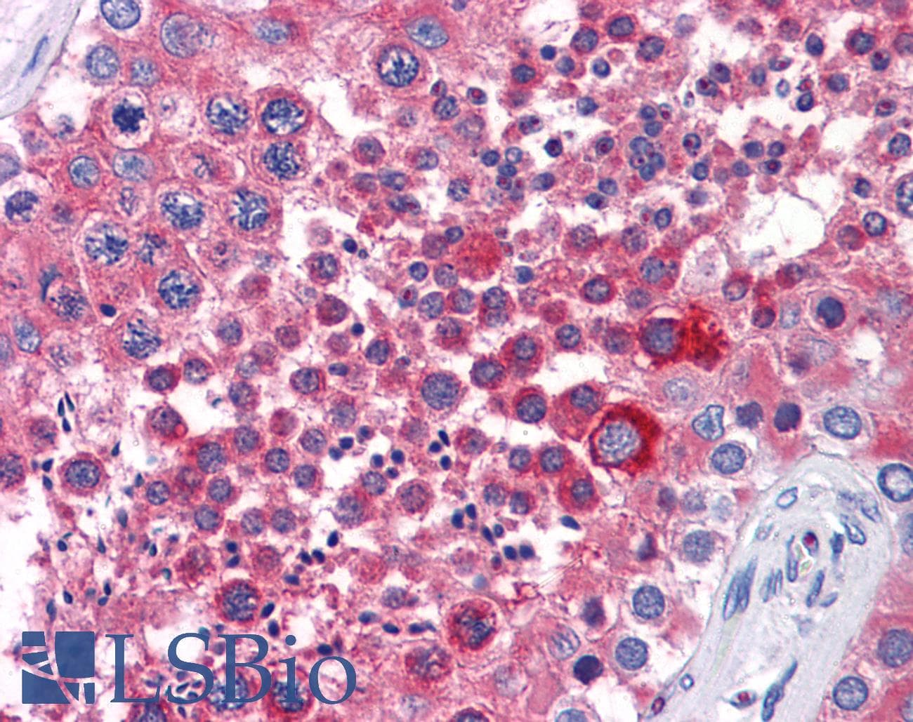 IHC-plus™ ISLET-1 / ISL1 Antibody (aa 150-349, clone 1H9)
