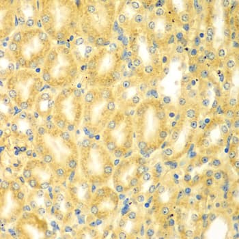 Polyclonal Rabbit anti-Human PDE4DIP / MMGL Antibody (IHC, WB)