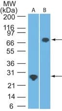 Monoclonal Mouse anti-Human DDX3 / DDX3X Antibody (clone 11F11D10, aa24-203, WB)