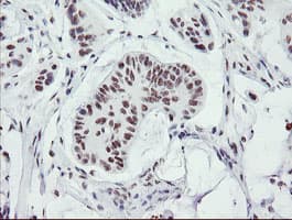 Monoclonal Mouse anti-Human SENP2 Antibody (clone OTI1H2, IHC, IF, WB)