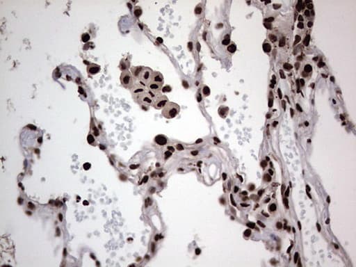 HNRNPL / hnRNP L Antibody (aa270-502, clone OTI2E4)