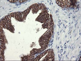 SLA2 / SLAP2 Antibody (clone OTI3A7)