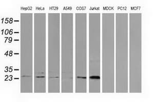 Monoclonal Mouse anti-Human CLPP Antibody (clone OTI1E8, IF, WB)