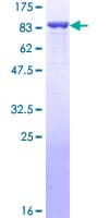 Human PRMT5 Protein (Recombinant GST)