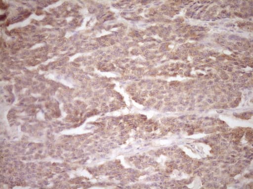 ERBB3 / HER3 Antibody (clone OTI3E10)