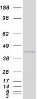 Human HOXD9 Protein (Recombinant Myc-DDK (Flag))